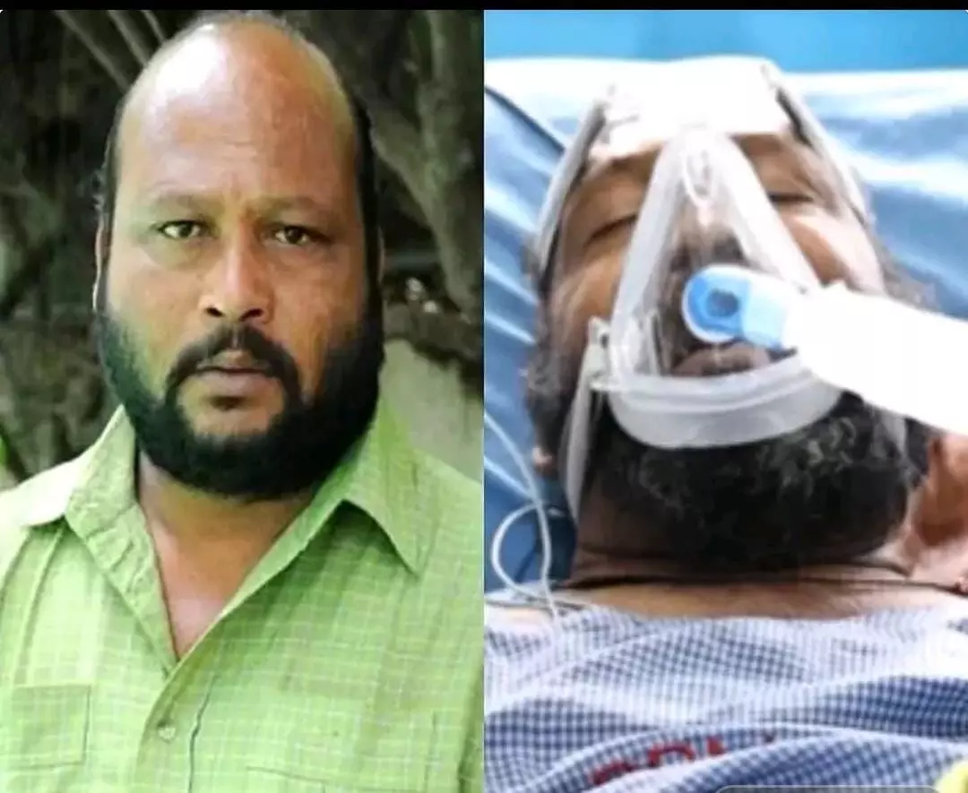ఫిష్ వెంకట్ ఆరోగ్యం విషమం ఫిష్ వెంకట్ ఆరోగ్యం విషమం